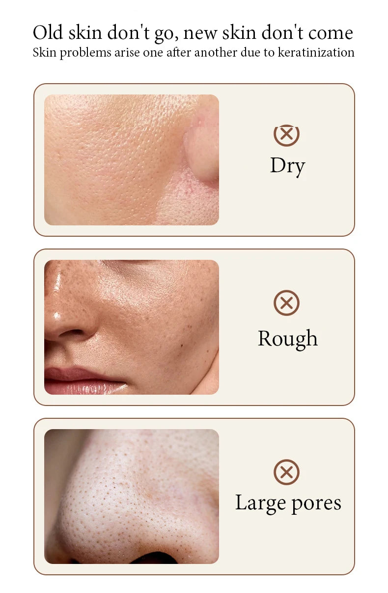 BIOAQUA Gel exfoliant pour le visage au riz blanc Hydratant Soins de la peau nourrissants Gommage pour le visage Crème pour le visage Exfoliants pour le visage Soins de la peau