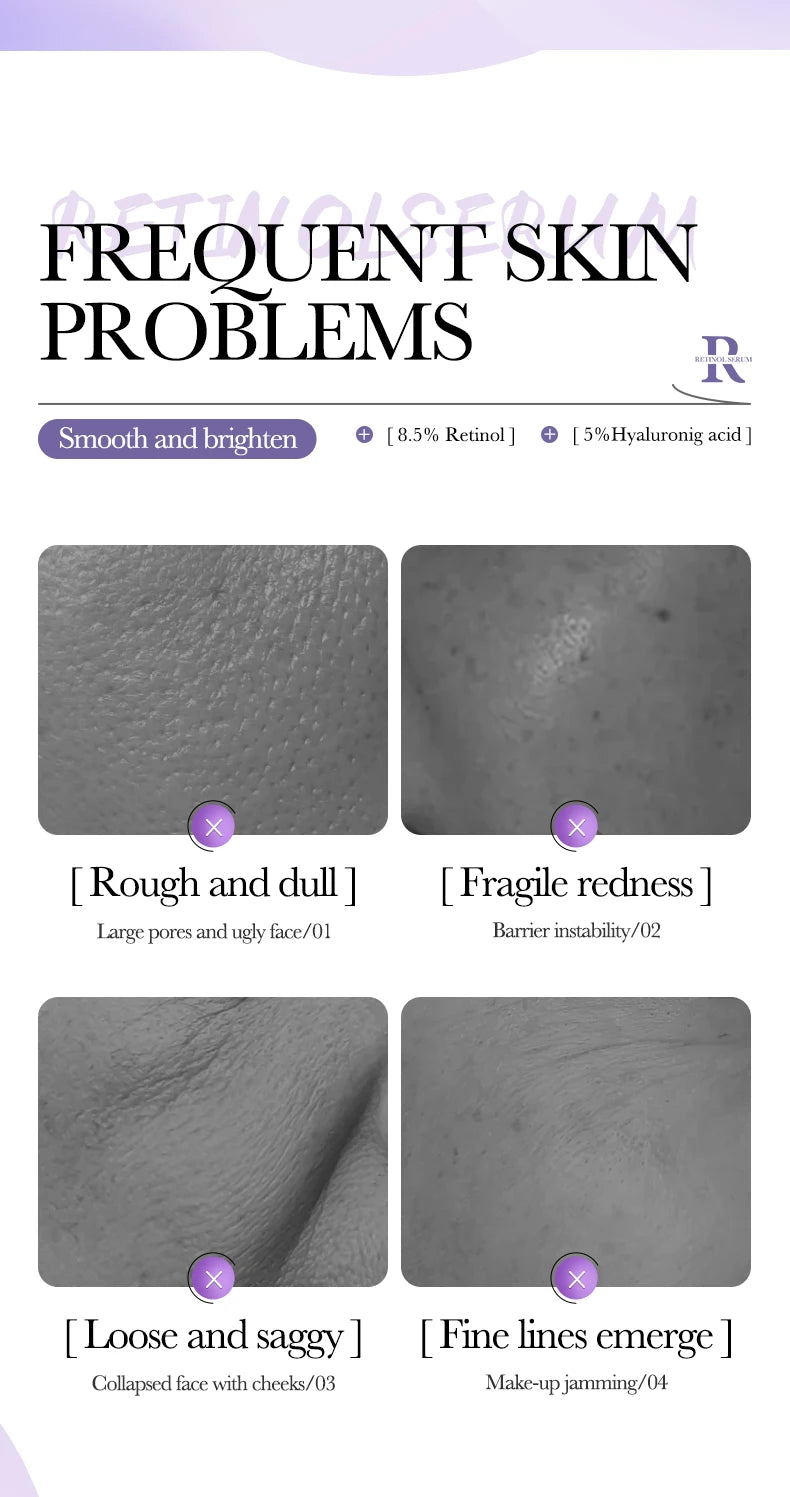 BIOAQUA – Sérum Visage Concentré à la Vitamine C, Rétinol & Acide Hyaluronique, Essence Anti-Âge Éclaircissante.