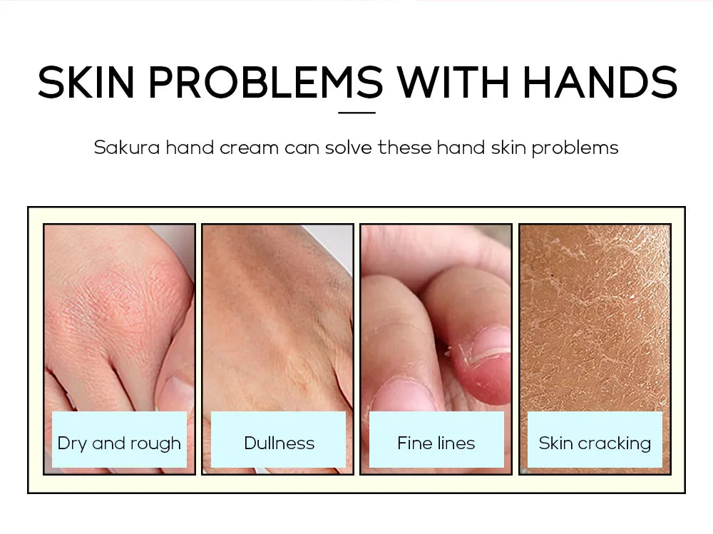 LAIKOU Sakura Crème pour les mains Blanchiment Élimination des rides Anti-fissure Hydratant Fade Lignes fines Corée Soins de la peau Santé Beauté 30g