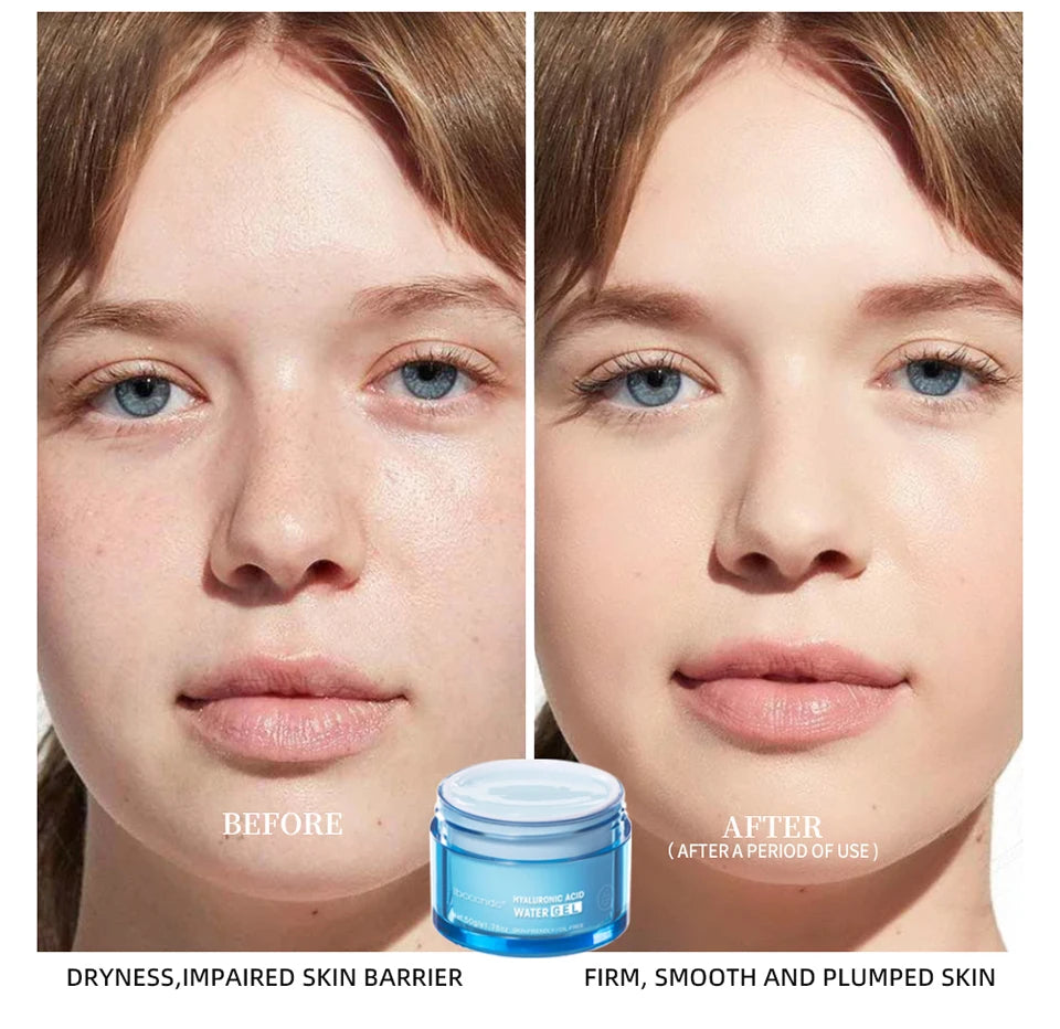 Crème en gel à l'acide hyaluronique Hydratant pour le visage hydratant pour hydrater et lisser la peau extra-sèche Nourrir améliorer le grains de peau
