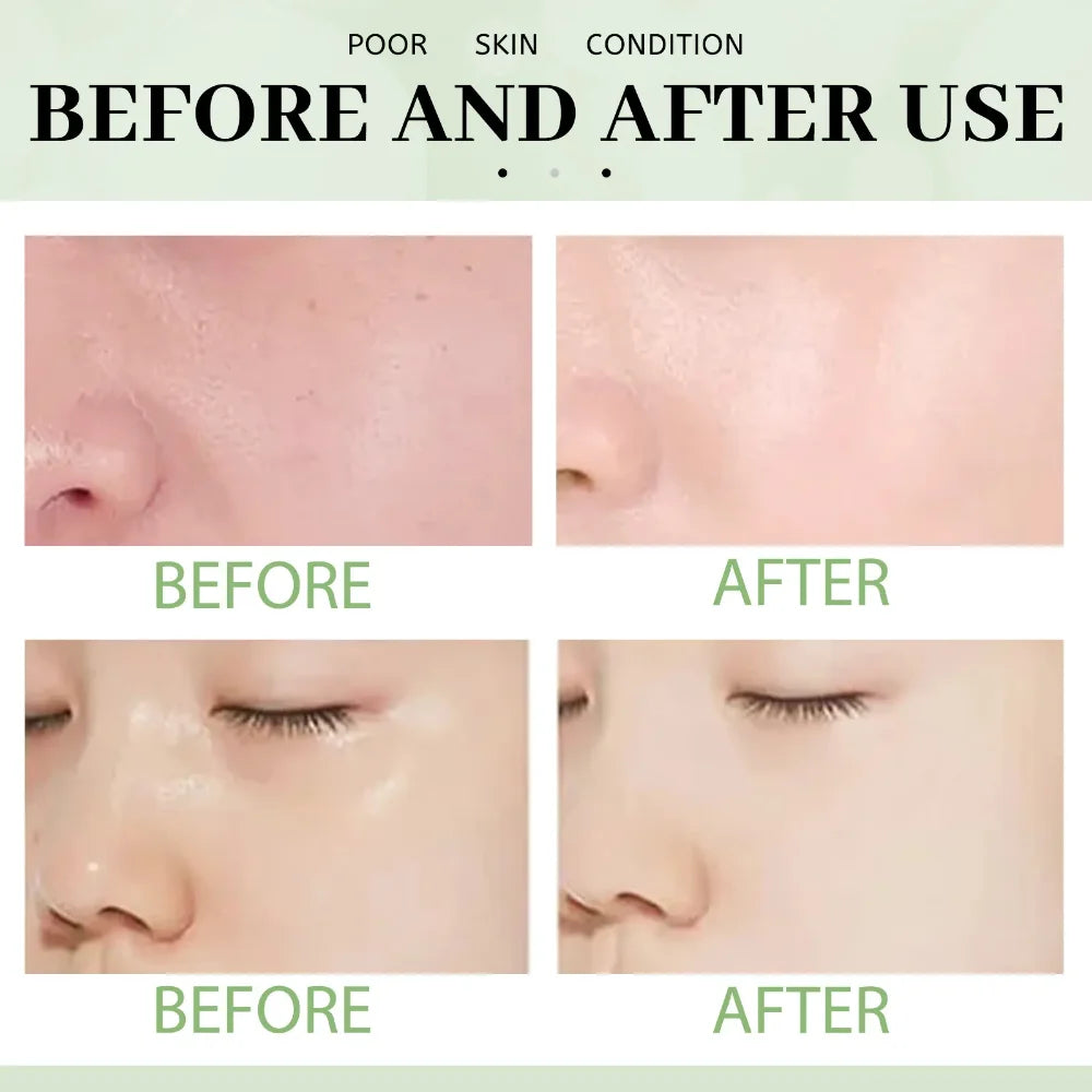 Masque facial solide nettoyant au thé vert Le bâtonnet nettoie les pores Élimine l'acné.