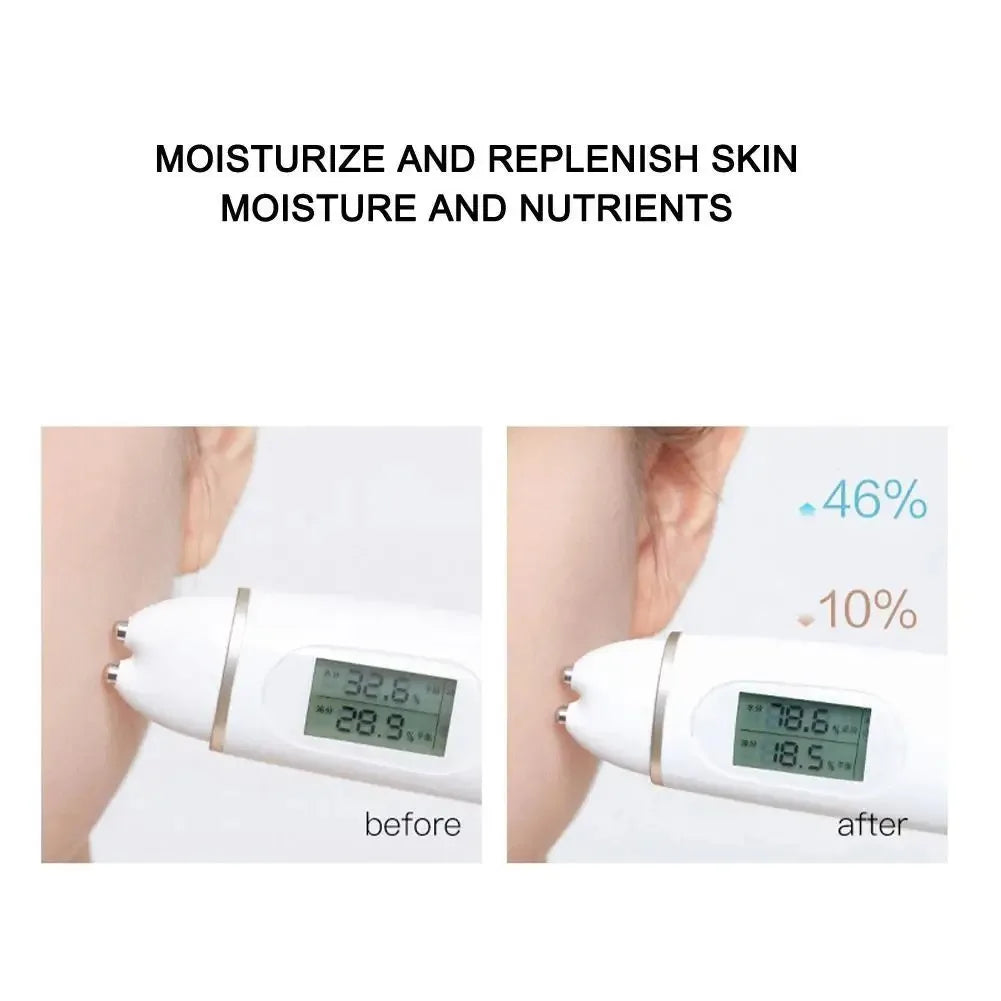 Fils solubles pour le lifting du visage, collagène, essence faciale et raffermissement de la peau