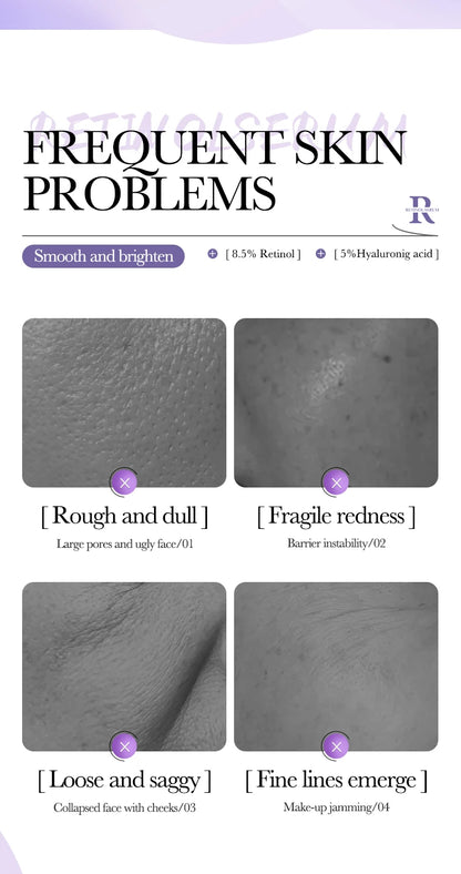 BIOAQUA – Sérum Visage Concentré à la Vitamine C, Rétinol & Acide Hyaluronique, Essence Anti-Âge Éclaircissante.